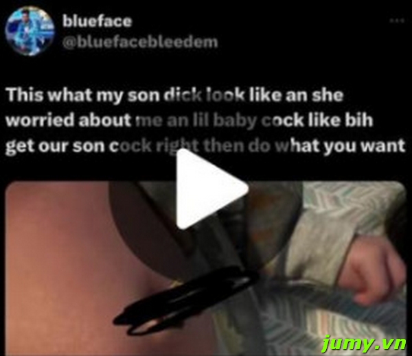 Blueface Baby Hernia Photo Leaked Viral on Twitter