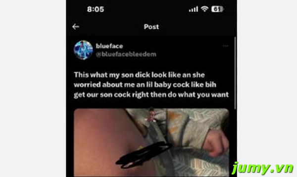 Blueface Baby Hernia Photo Leaked Viral on Twitter